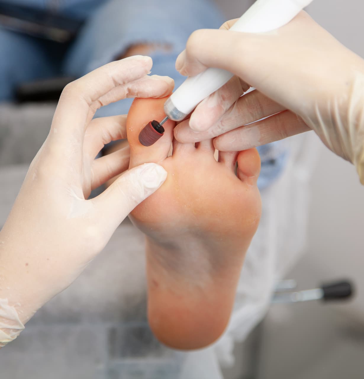 Tratamientos podológicos en Ares que devuelven salud a tus pies